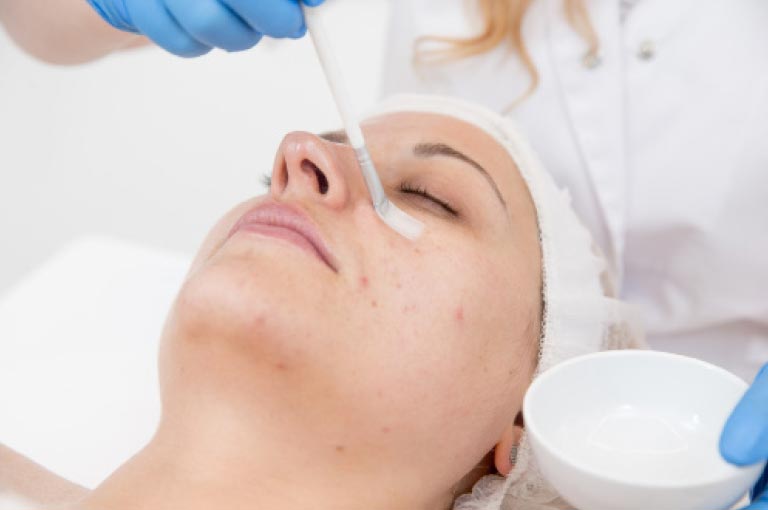 Cosmetic Treatments Chemical Peels available in Bahrain