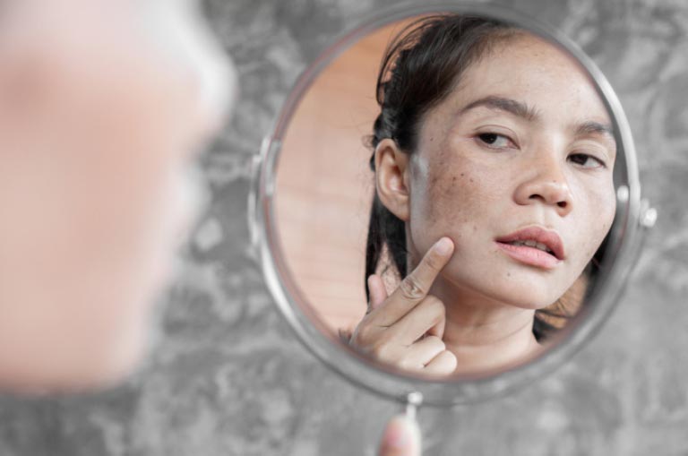 Microneedling treatment risks in Bahrain